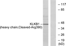 KLKB1 / Plasma Kallikrein Antibody - Western blot of extracts from HeLa cells, using KLKB1 (heavy chain, Cleaved-Arg390) Antibody. The lane on the right is treated with the synthesized peptide.