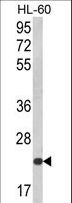 KLRC2 / NKG2C / CD159c Antibody - Western blot of KLRC2 Antibody in HL-60 cell line lysates (35 ug/lane). KLRC2 (arrow) was detected using the purified antibody.