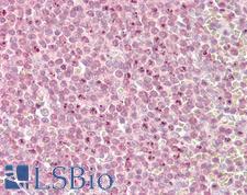 KMT2D / MLL2 Antibody - Anti-MLL2 antibody IHC of human spleen. Immunohistochemistry of formalin-fixed, paraffin-embedded tissue after heat-induced antigen retrieval. Antibody dilution 3.75 ug/ml.