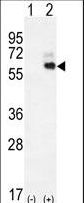 KNG1 / Kininogen / Bradykinin Antibody - Western blot of KNG1 (arrow) using rabbit polyclonal KNG1 Antibody. 293 cell lysates (2 ug/lane) either nontransfected (Lane 1) or transiently transfected (Lane 2) with the KNG1 gene.
