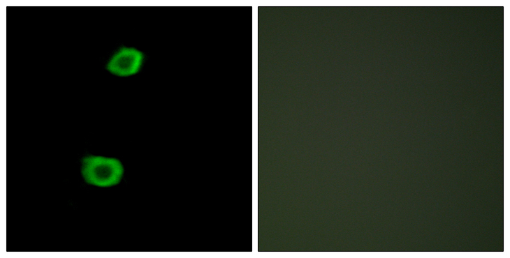 KPI-2 / LMTK2 Antibody - Immunofluorescence analysis of HepG2 cells, using LMTK2 Antibody. The picture on the right is blocked with the synthesized peptide.