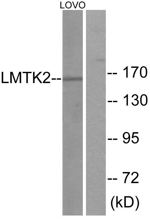 KPI-2 / LMTK2 Antibody - Western blot analysis of lysates from LOVO cells, using LMTK2 Antibody. The lane on the right is blocked with the synthesized peptide.