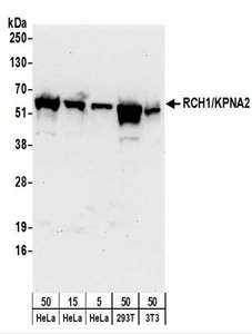 KPNA2 / Importin Alpha 1 Antibody - Detection of Human and Mouse RCH1/KPNA2 by Western Blot. Samples: Whole cell lysate from HeLa (5, 15, and 50 ug), 293T (50 ug), and mouse NIH3T3 (50 ug) cells. Antibodies: Affinity purified rabbit anti-RCH1/KPNA2 antibody used for WB at 0.04 ug/ml. Detection: Chemiluminescence with an exposure time of 30 seconds.