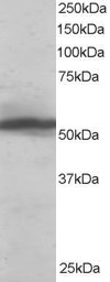 KPNA2 / Importin Alpha 1 Antibody - Antibody staining (0.1 ug/ml) of HeLa lysate (RIPA buffer, 35 ug total protein per lane). Primary incubated for 1 hour. Detected by Western blot of chemiluminescence.