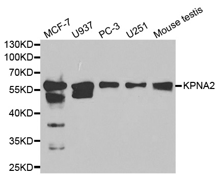 KPNA2 / Importin Alpha 1 Antibody - Western blot analysis of extracts of various cell lines, using KPNA2 antibody at 1:1000 dilution. The secondary antibody used was an HRP Goat Anti-Rabbit IgG (H+L) at 1:10000 dilution. Lysates were loaded 25ug per lane and 3% nonfat dry milk in TBST was used for blocking.
