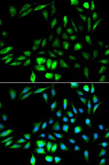 KPNA2 / Importin Alpha 1 Antibody - Immunofluorescence analysis of MCF-7 cells using KPNA2 antibody. Blue: DAPI for nuclear staining.