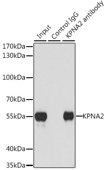 KPNA2 / Importin Alpha 1 Antibody - Immunoprecipitation analysis of 200ug extracts of U-251MG cells, using 3 ug KPNA2 antibody. Western blot was performed from the immunoprecipitate using KPNA2 antibodyat a dilition of 1:1000.