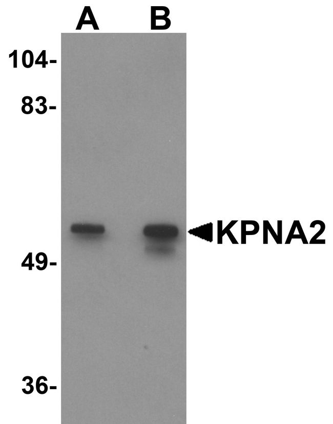 KPNA2 / Importin Alpha 1 Antibody - Western blot analysis of KPNA2 in rat heart tissue lysate with KPNA2 antibody at (A) 1 and (B) 2 ug/ml.