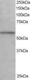 KPNA3 / Importin Alpha 4 Antibody - Antibody staining (0.1 ug/ml) of Human Testis lysate (RIPA buffer, 35 ug total protein per lane). Primary incubated for 1 hour. Detected by Western blot of chemiluminescence.