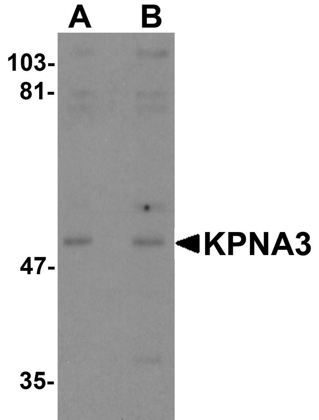 KPNA3 / Importin Alpha 4 Antibody - Western blot analysis of KPNA3 in EL4 cell lysate with KPNA3 antibody at (A) 1 and (B) 2 ug/ml.