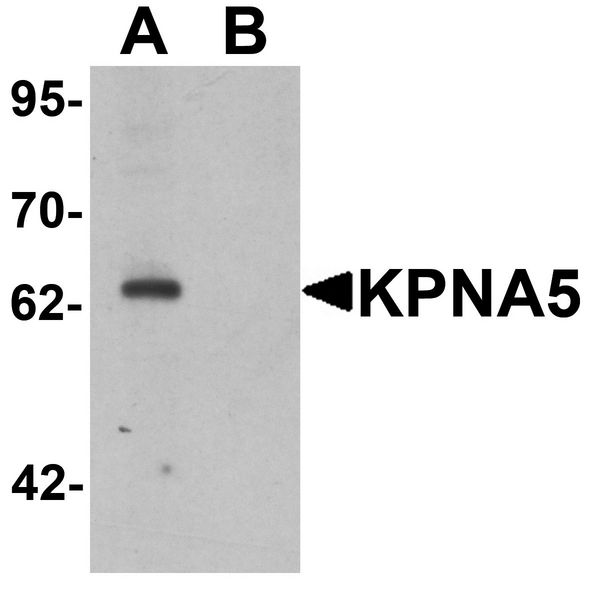 KPNA5 Antibody - Western blot analysis of KPNA6 in EL4 cell lysate with KPNA5 antibody at 1 ug/ml in (A) the absence and (B) the presence of blocking peptide.