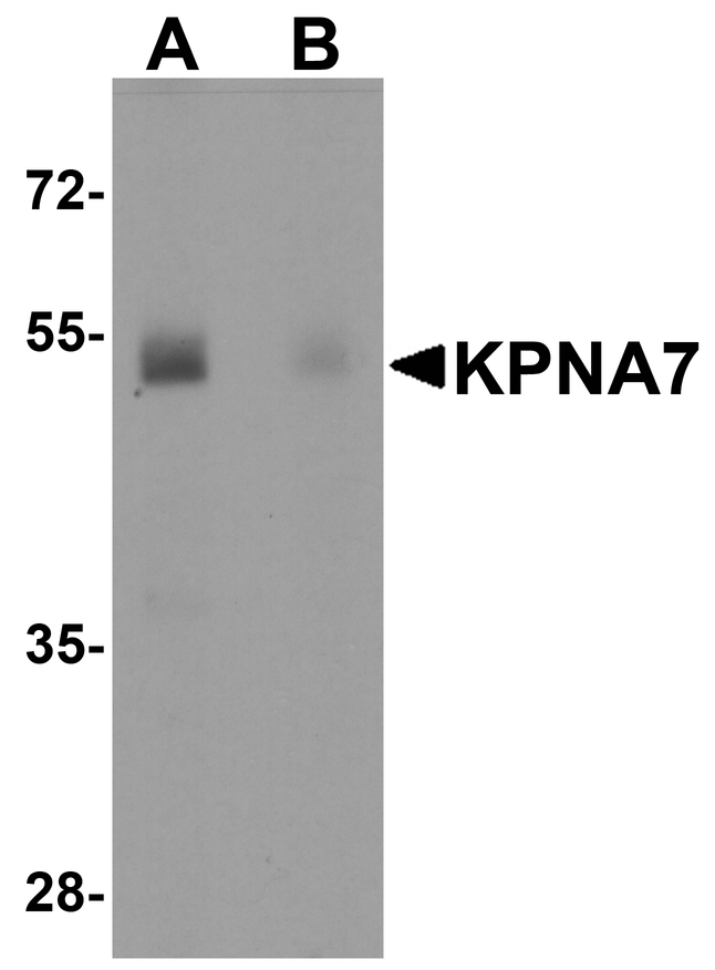 KPNA7 Antibody - Western blot analysis of KPNA7 in human spleen with KPNA7 antibody at 1 ug/ml in (A) the absence and (B) the presence of blocking peptide.
