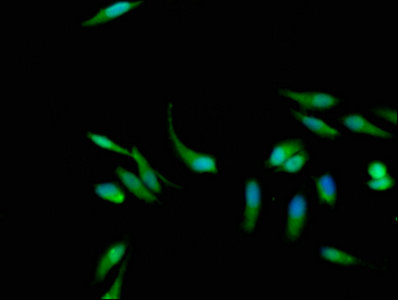 KRAS Antibody - Immunofluorescence staining of Hela cells with Rabbit anti-human GTPase KRas polyclonal Antibody at 1:133, counter-stained with DAPI. The cells were fixed in 4% formaldehyde, permeabilized using 0.2% Triton X-100 and blocked in 10% normal Goat Serum. The cells were then incubated with the antibody overnight at 4°C. The secondary antibody was Alexa Fluor 488-congugated AffiniPure Goat Anti-Rabbit IgG(H+L).