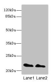 KRAS Antibody - Western blot All lanes: KRAS antibody at 2µg/ml Lane 1: Mouse brain tissue Lane 2: Mouse kidney tissue Secondary Goat polyclonal to rabbit IgG at 1/10000 dilution Predicted band size: 22 kDa Observed band size: 22 kDa
