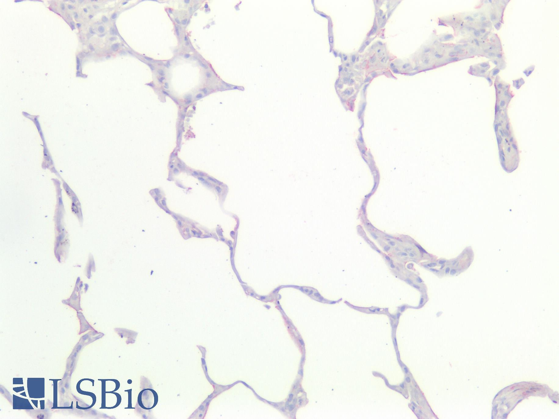KRAS Antibody - Human Lung: Formalin-Fixed, Paraffin-Embedded (FFPE)