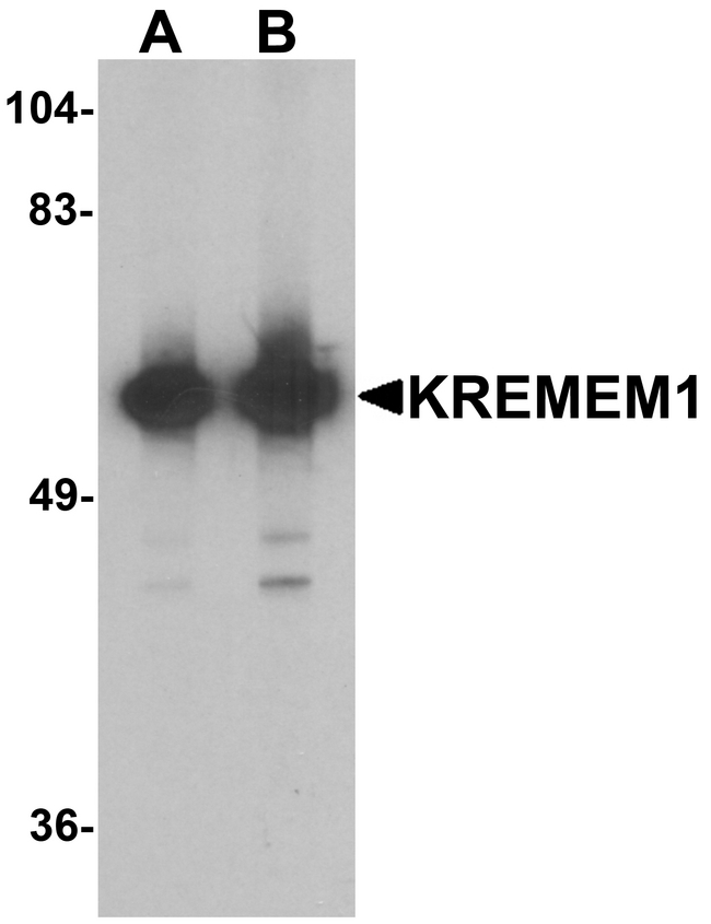 KREMEN1 / KREMEN-1 Antibody - Western blot analysis of KREMEN1 in rat small intestine tissue lysate with KREMEN1 antibody at (A) 0.5 and (B) 1 ug/ml