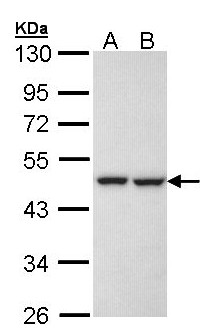 KRR1 Antibody - Sample (30 ug of whole cell lysate). A: H1299, B: Hela. 10% SDS PAGE. RIP-1 / KRR1 antibody diluted at 1:1000