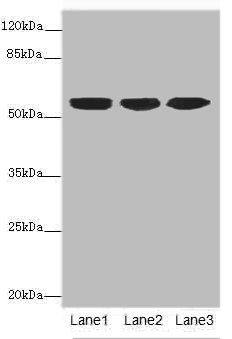 KRT10 / CK10 / Cytokeratin 10 Antibody - All lanes: KRT10 antibody at 6ug/ml Lane 1 : A431 whole cell lysate Lane 2 : HepG-2 whole cell lysate Lane 3 : MCF7 whole cell lysate Secondary Goat polyclonal to Rabbit IgG at 1/10000 dilution Predicted band size: 59 kDa Observed band size: 59 kDa