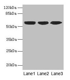 KRT10 / CK10 / Cytokeratin 10 Antibody - Western blot All lanes: KRT10 antibody at 6µg/ml Lane 1: A431 whole cell lysate Lane 2: HepG2 whole cell lysate Lane 3: MCF-7 whole cell lysate Secondary Goat polyclonal to rabbit IgG at 1/10000 dilution Predicted band size: 59 kDa Observed band size: 59 kDa