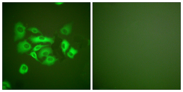 KRT10 / CK10 / Cytokeratin 10 Antibody - Immunofluorescence analysis of A549 cells, using Keratin 10 Antibody. The picture on the right is blocked with the synthesized peptide.