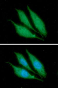 KRT14 / CK14 / Cytokeratin 14 Antibody - ICC/IF analysis of KRT14 in PC3 cells. The cell was stained with  KRT14 antibody (1:100).The secondary antibody (green) was used Alexa Fluor 488. DAPI was stained the cell nucleus (blue).