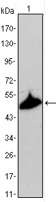 KRT15 / CK15 / Cytokeratin 15 Antibody - Western blot using KRT15 mouse monoclonal antibody against A431 cell lysate.