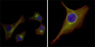 KRT15 / CK15 / Cytokeratin 15 Antibody - Immunofluorescence of HepG2(left) and PACN-1 (right) cells using KRT15 mouse monoclonal antibody (green). Red: Actin filaments have been labeled with DY-554 phalloidin. Blue: DRAQ5 fluorescent DNA dye.