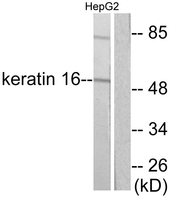 KRT16 / CK16 / Cytokeratin 16 Antibody - Western blot analysis of lysates from HepG2 cells, using Keratin 16 Antibody. The lane on the right is blocked with the synthesized peptide.