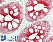 KRT16 / CK16 / Cytokeratin 16 Antibody - Human Colon: Formalin-Fixed, Paraffin-Embedded (FFPE)