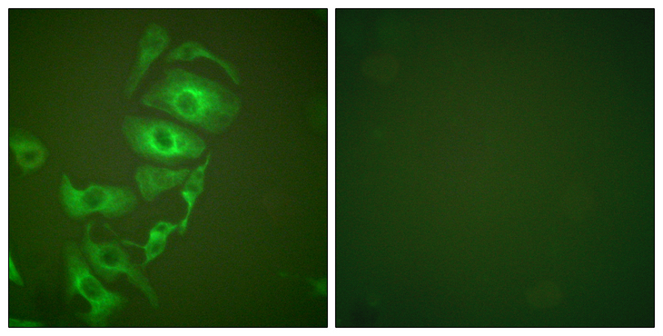 KRT17 / CK17 / Cytokeratin 17 Antibody - Immunofluorescence analysis of HepG2 cells, using Keratin 17 Antibody. The picture on the right is blocked with the synthesized peptide.