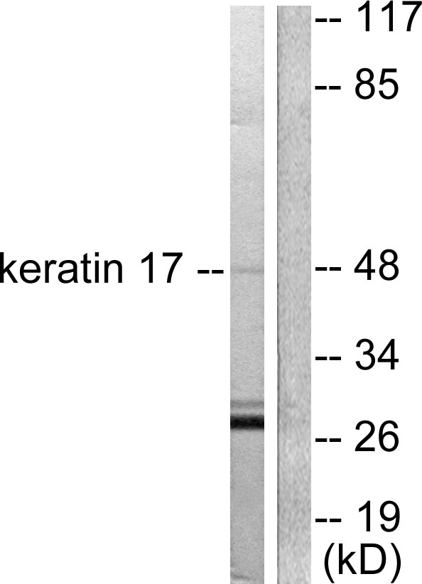 KRT17 / CK17 / Cytokeratin 17 Antibody - Western blot analysis of lysates from HUVEC cells, using Keratin 17 Antibody. The lane on the right is blocked with the synthesized peptide.