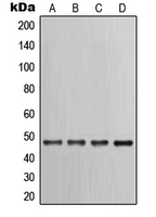KRT17 / CK17 / Cytokeratin 17 Antibody - Western blot analysis of Cytokeratin 17 expression in PC12 (A); HeLa (B); A431 (C); NIH3T3 (D) whole cell lysates.