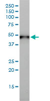 KRT17 / CK17 / Cytokeratin 17 Antibody - Western blot of KRT17 expression in A-431 cell lysate.