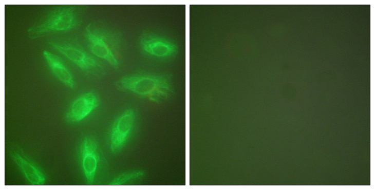 KRT18 / CK18 / Cytokeratin 18 Antibody - Immunofluorescence analysis of HeLa cells, using Keratin 18 Antibody. The picture on the right is blocked with the synthesized peptide.
