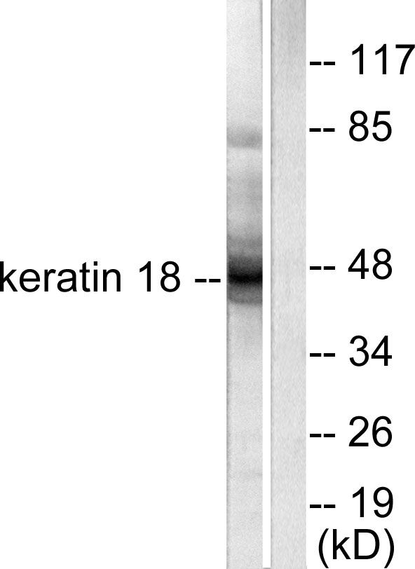 KRT18 / CK18 / Cytokeratin 18 Antibody - Western blot analysis of lysates from HeLa cells, using Keratin 18 Antibody. The lane on the right is blocked with the synthesized peptide.