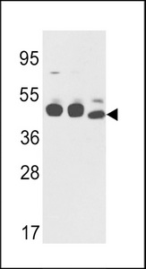 KRT18 / CK18 / Cytokeratin 18 Antibody - Western blot of CYK18 Antibody in K562,NCI-H460 cell line lysates and mouse stomach tissues lysates(35 ug/lane). CYK18(arrow) was detected using the purified antibody.