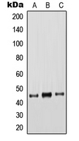KRT18 / CK18 / Cytokeratin 18 Antibody - Western blot analysis of Cytokeratin 18 expression in HeLa (A); A431 (B); MCF7 (C) whole cell lysates.