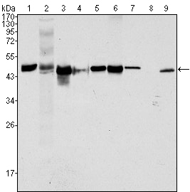 KRT18 / CK18 / Cytokeratin 18 Antibody - Western blot using CK18 mouse monoclonal antibody against HeLa (1), NIH/3T3 (2), A549 (3), Jurkat (4), MCF-7(5), HepG2 (6), A431 (7), HEK293 (8) and K562 (9) cell lysate.