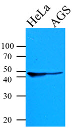KRT18 / CK18 / Cytokeratin 18 Antibody - Cell lysates of HeLa and AGS (35 ug) were resolved by SDS-PAGE, transferred to PVDF membrane and probed with anti-human KRT18 (1:1000). Proteins were visualized using a goat anti-mouse secondary antibody conjugated to HRP and an ECL detection system.
