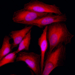 KRT18 / CK18 / Cytokeratin 18 Antibody - Immunofluorescence of HeLa cells stained with Hoechst 3342 (Blue) for nucleus staining and monoclonal anti-human KRT18 antibody (1:500) with Texas Red (Red).