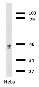 KRT18 / CK18 / Cytokeratin 18 Antibody - Western blotting analysis of cytokeratin 18 in HeLa cells with anti-cytokeratin 18 (C-04) biotin.