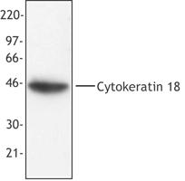 KRT18 / CK18 / Cytokeratin 18 Antibody - MCF-7 cell extract was resolved by electrophoresis, transferred to nitrocellulose and probed with monoclonal anti-cytokeratin 18 antibody (clone DA-7). Proteins were visualized using a goat anti-mouse secondary conjugated to HRP and a chemiluminescence detection system.