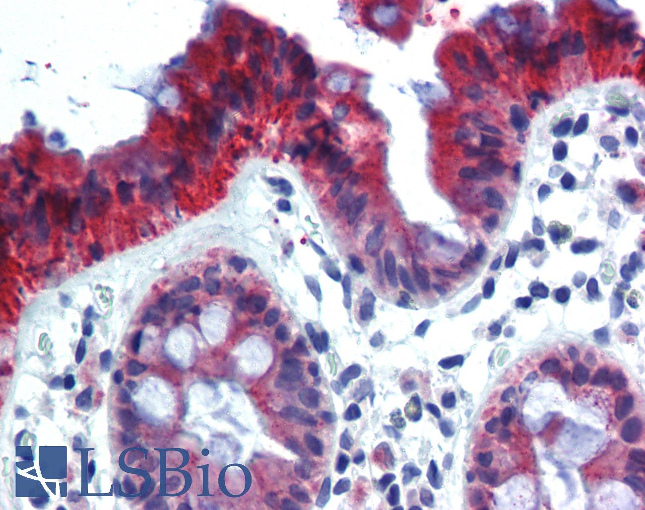 KRT18 / CK18 / Cytokeratin 18 Antibody - Anti-KRT18 / Cytokeratin 18 antibody IHC of human colon. Immunohistochemistry of formalin-fixed, paraffin-embedded tissue after heat-induced antigen retrieval. Antibody dilution 1:10. This image was taken for the unconjugated form of this product. Other forms have not been tested.