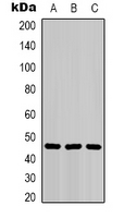 KRT18 / CK18 / Cytokeratin 18 Antibody - Western blot analysis of Cytokeratin 18 expression in HeLa (A); HepG2 (B); mouse skeletal muscle (C) whole cell lysates.