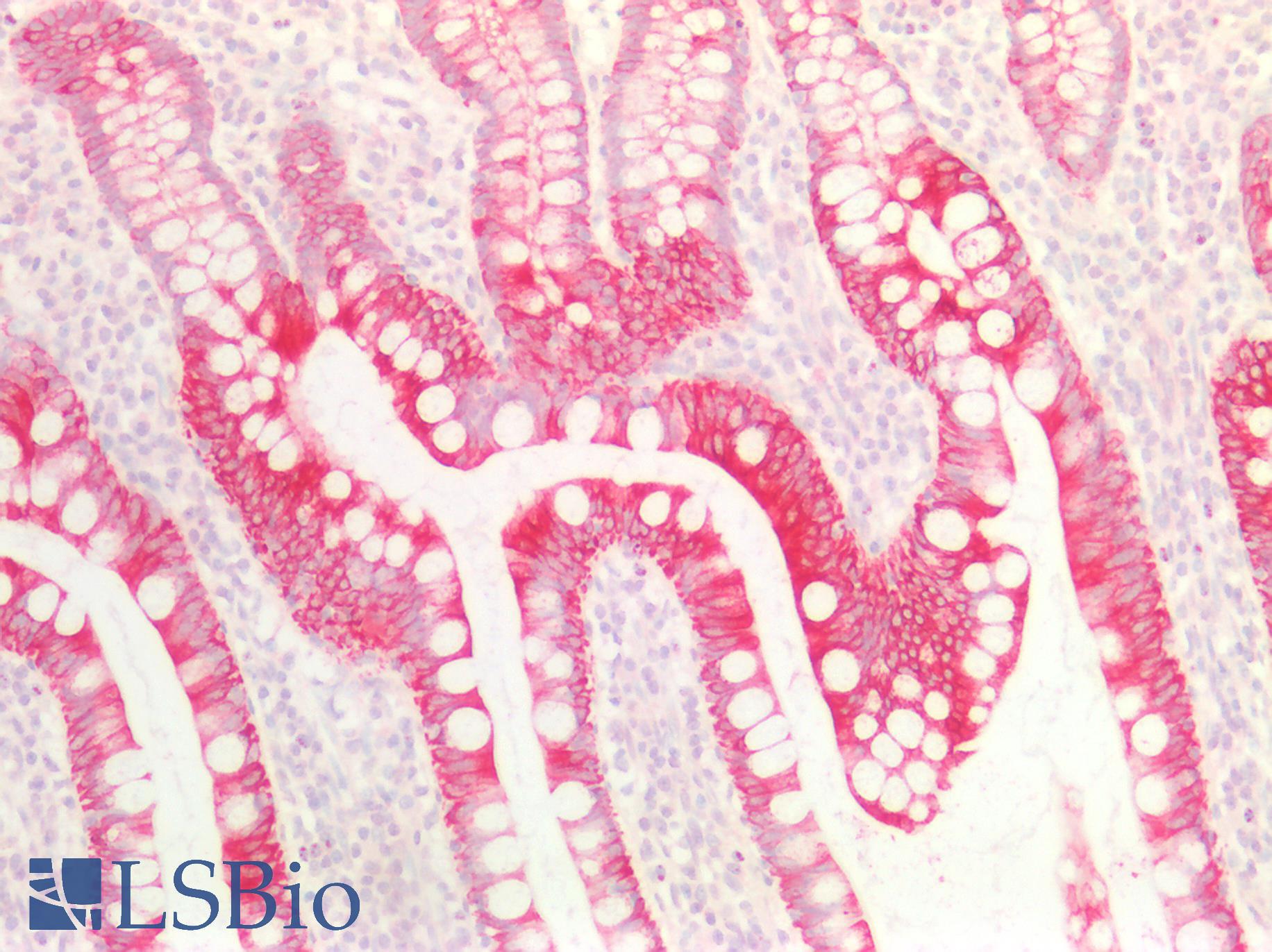 KRT18 / CK18 / Cytokeratin 18 Antibody - Human Small Intestine: Formalin-Fixed, Paraffin-Embedded (FFPE)