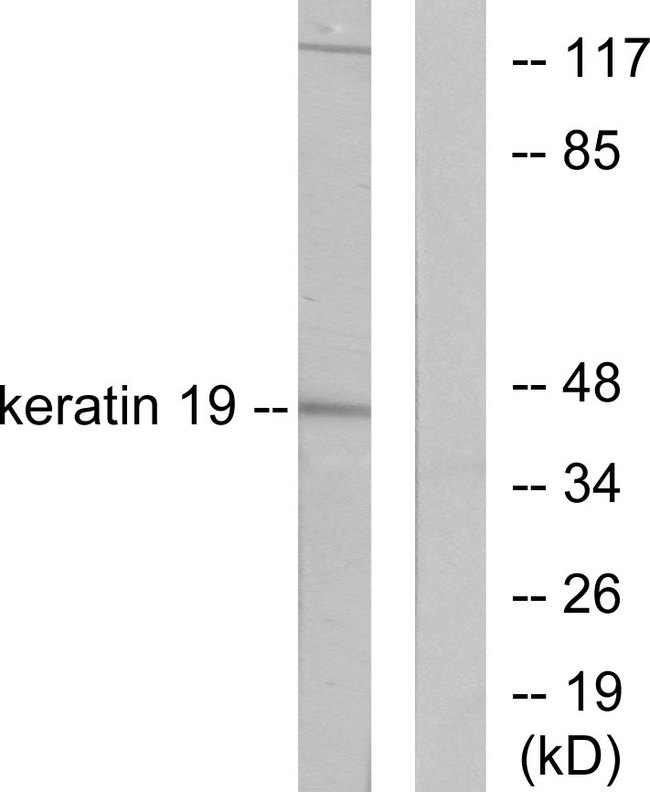 KRT19 / CK19 / Cytokeratin 19 Antibody - Western blot analysis of lysates from LOVO cells, using Keratin 19 Antibody. The lane on the right is blocked with the synthesized peptide.
