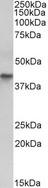 KRT19 / CK19 / Cytokeratin 19 Antibody - KRT19 antibody E12359 (0.03 ug/ml) staining of Human Colon cancer lysate (35 ug protein in RIPA buffer). Primary incubation was 1 hour. Detected by chemiluminescence.
