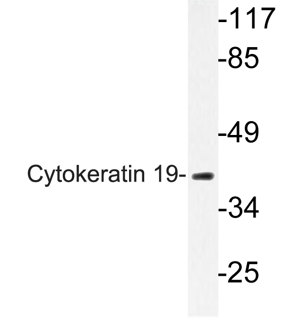 KRT19 / CK19 / Cytokeratin 19 Antibody - Western blot analysis of lysate from K562 cells, using CytokeratinÂ 19 antibody.