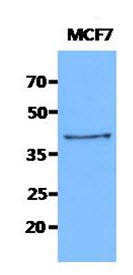KRT19 / CK19 / Cytokeratin 19 Antibody - Western Blot: The cell lysates of MCF7 (40 ug) were resolved by SDS-PAGE, transferred to PVDF membrane and probed with anti-human KRT19 antibody (1:1000). Proteins were visualized using a goat anti-mouse secondary antibody conjugated to HRP and an ECL detection system.