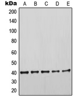 KRT19 / CK19 / Cytokeratin 19 Antibody - Western blot analysis of Cytokeratin 19 expression in HeLa (A); MCF7 (B); SKBR3 (C); MDAMB435 (D); HEK293T (E) whole cell lysates.